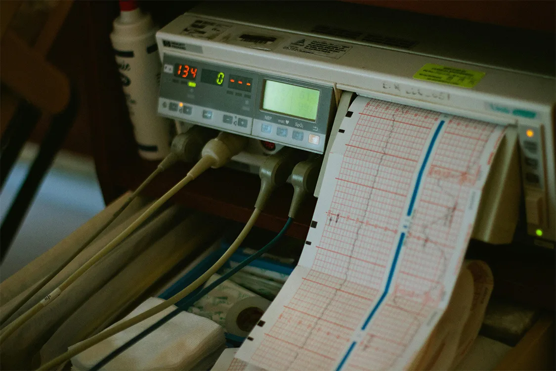 ECG-1125x750