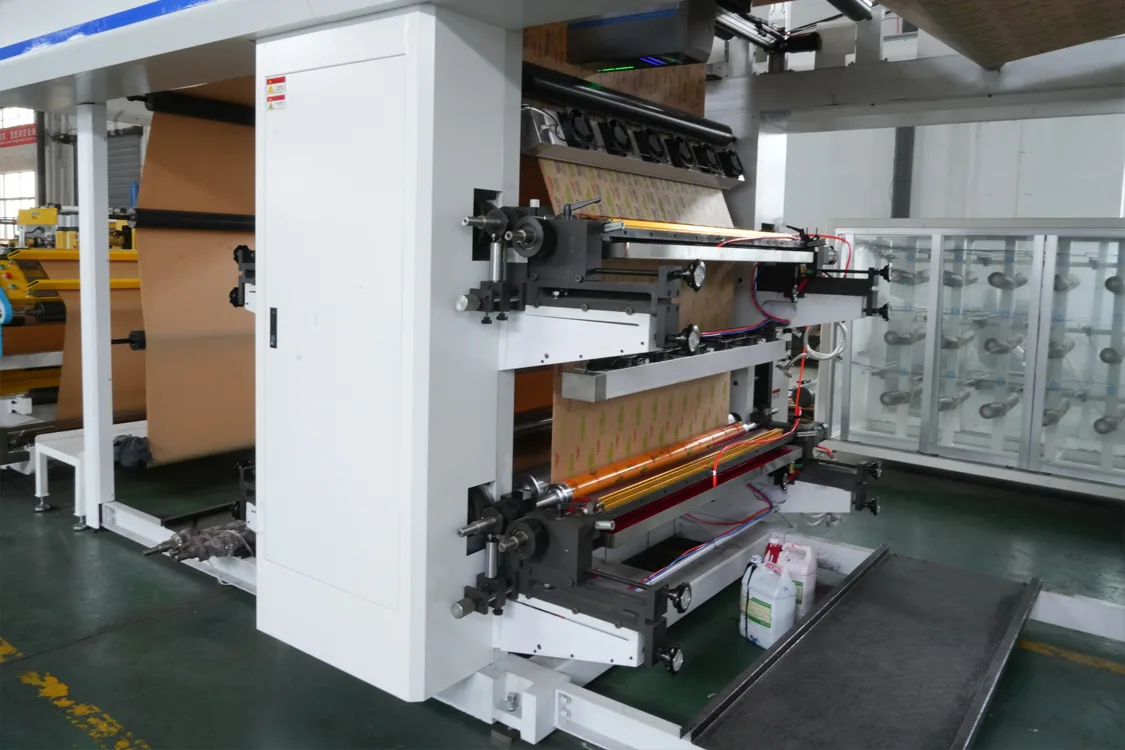 Vision-Based Print Inspection